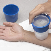 Cryocup™ Ice Massage Device