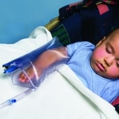 Pediatric Urias® Air Splints