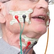 VitalStim® Therapy Electrodes