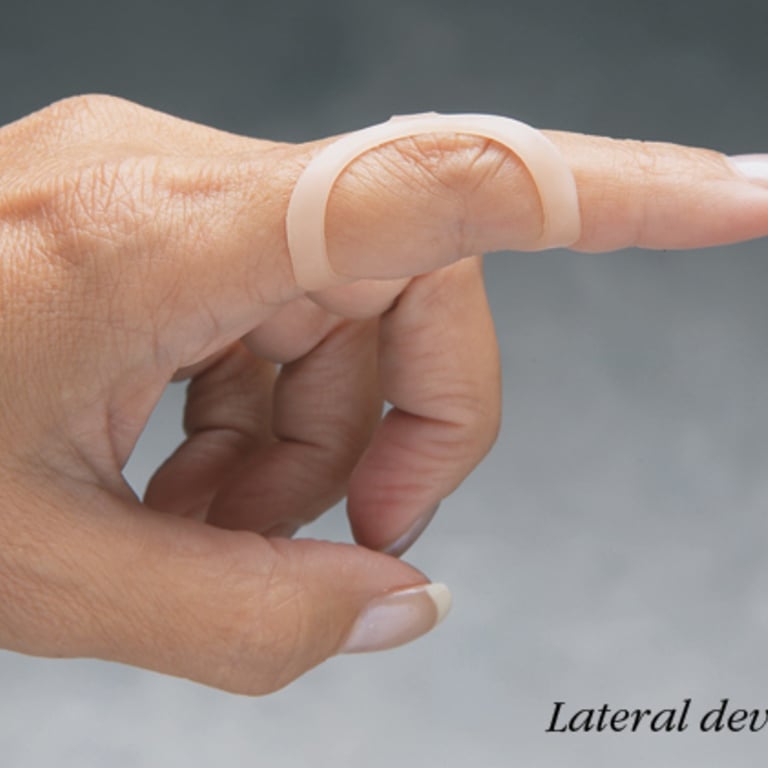Adjustable Finger Protector Trigger Finger Splint Brace with Aluminium Bar  Hook & Loop Straps Treatment for Sprains, Pain Relief, Mallet Injury,  Arthritis, Tendonitis - Walmart.com